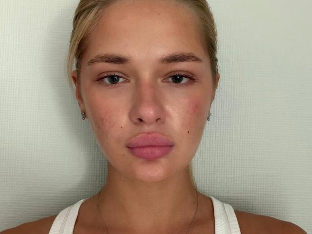 El rostro de Dorine Neuenfeldt, con cabello rubio, labios rosados y voluminosos, piel clara, pequeñas pecas, ojos verdes y una camiseta blanca sin mangas, sobre un fondo liso. Sus senos no son visibles..