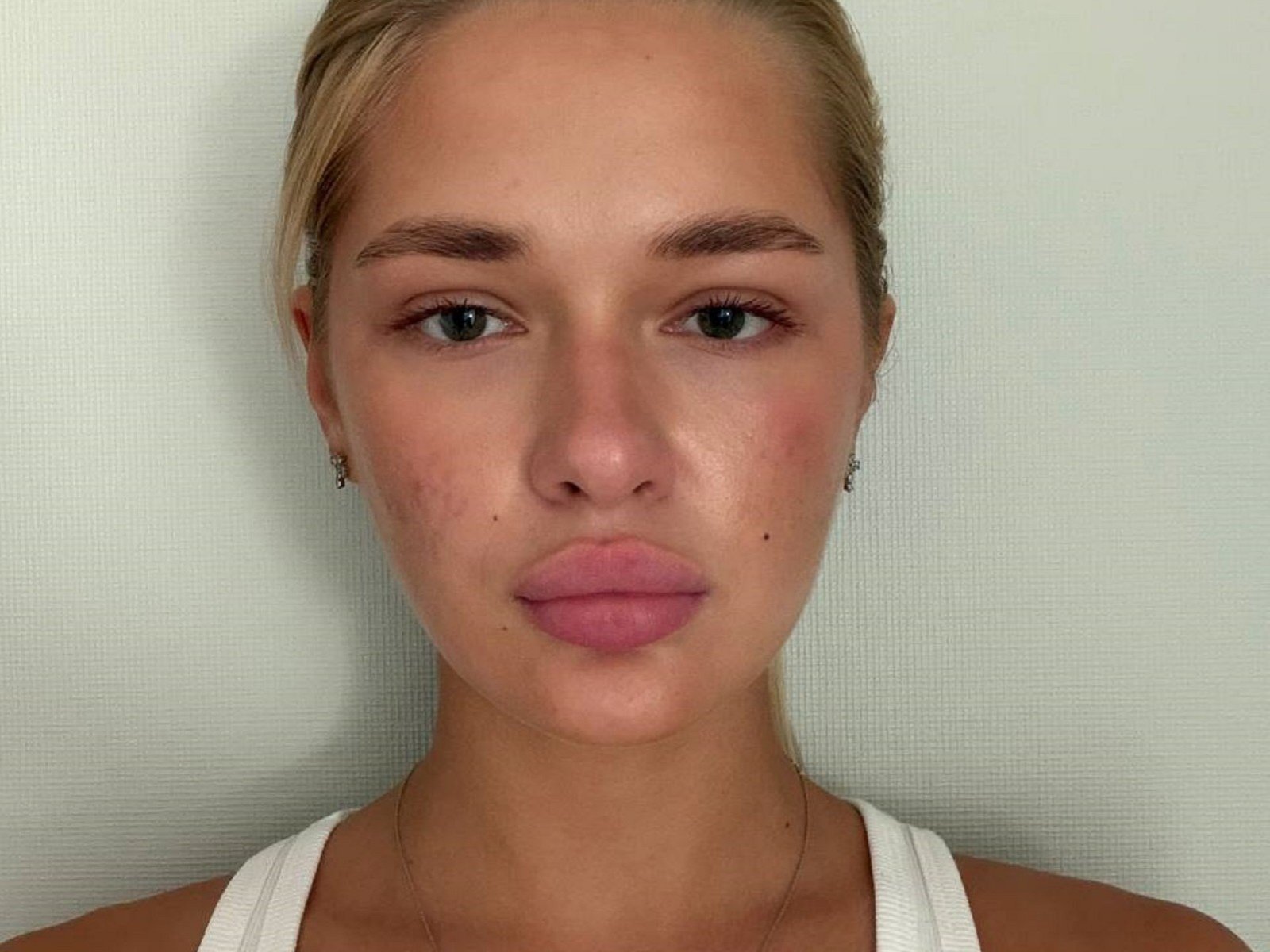 Le visage de Dorine Neuenfeldt, avec ses cheveux blonds, ses lèvres roses et gonflées, sa peau claire, ses petites taches de rousseur, ses yeux verts et son débardeur blanc, sur un fond uni. Ses seins ne sont pas visibles..