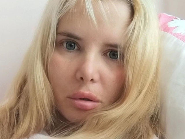 ElenaSchatz-hot tiene cabello rubio, ojos azules y labios rosados, y parece ligeramente confundida con una expresión neutra. Su rostro está centrado en la imagen, mostrando una piel suave y clara..