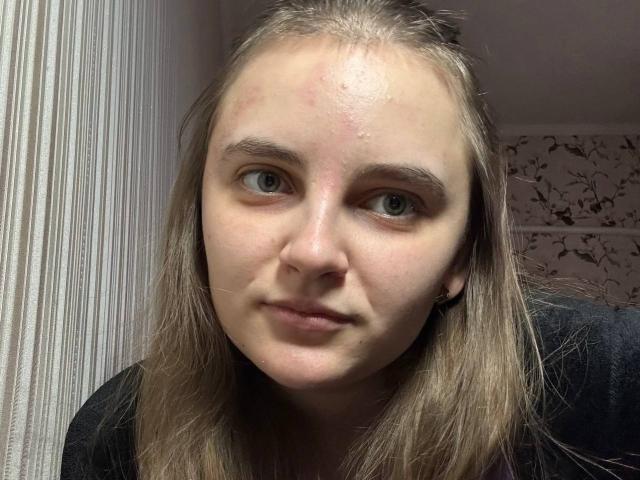 Bileira has a pimple on her forehead, light blue eyes, and straight brown hair. She's wearing a black shirt with a slight smile on her face.