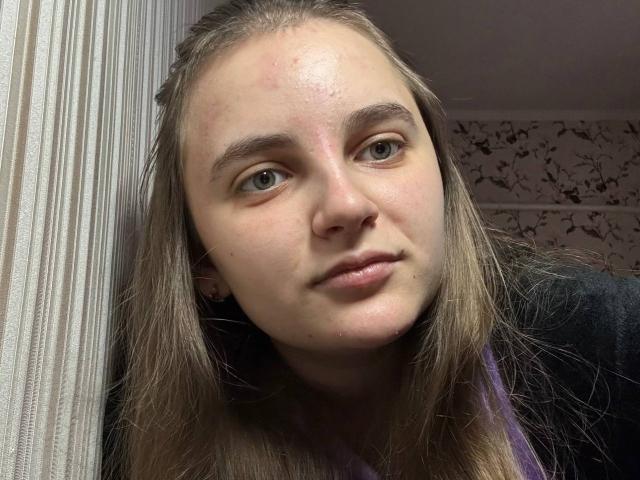 Bileira has long brown hair, a slightly flushed face with small red bumps, green eyes, and is wearing a purple shirt with a black collar. Her lips are slightly parted.