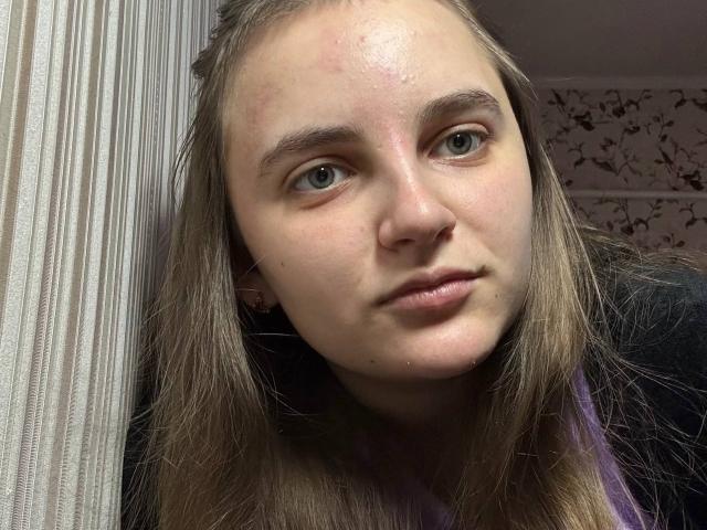 Bileira has a pimple on her forehead, light skin, and green eyes with long brown hair. She's wearing a purple shirt and has a slight, serious expression.