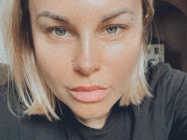 BelleLisaG has a serious face with green eyes, pink lips, and blonde shoulder-length hair, wearing a black shirt, with small dark spots on her skin.