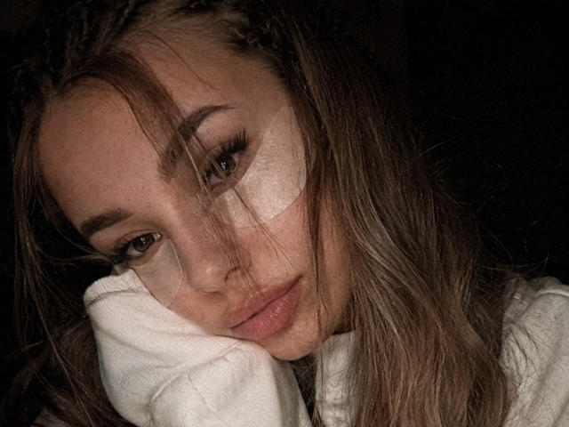 Niferttiti with brown braids, a white bandage over her right eye, and a serious expression, resting her head on a white cloth. Her brown eyes are slightly downcast.