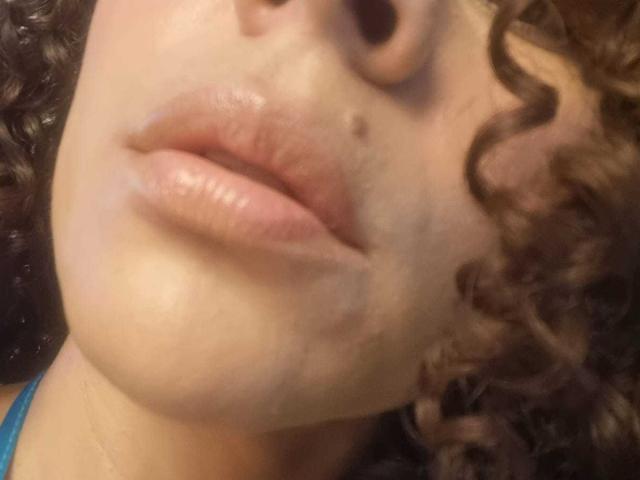 MissSunnyShine's pouty, shiny-ass lips with a small mole above her upper lip, curly brown hair, and a slight shadow on her left cheek. Her skin is light.