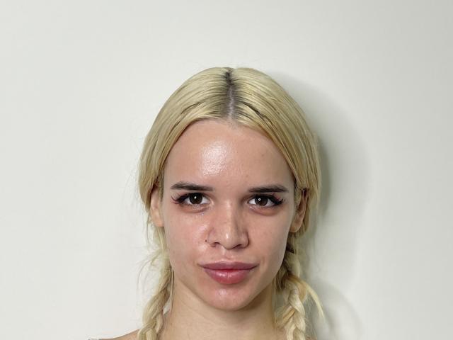 MirianWelti has blonde braids, brown eyes, and pink lips, with a slight smile, looking directly at the camera, showing a shiny forehead and no visible makeup.