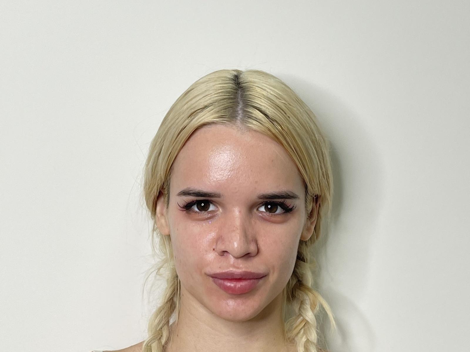 MirianWelti has blonde braids, brown eyes, and pink lips, with a slight smile, looking directly at the camera, showing a shiny forehead and no visible makeup.