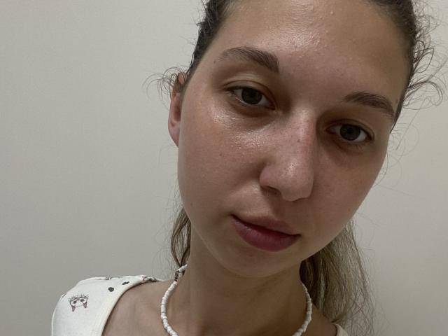 Sanella's face, showing a slightly shiny, freckled complexion with brown eyes, subtle makeup, and a white floral top with a pearl necklace. She's looking directly at the camera.