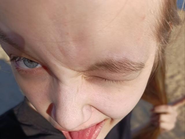 TomikoHelfritz's face with one eye closed, her tongue slightly out, showing a small cut on her nose. She has blue eyes, light skin, and brown hair.