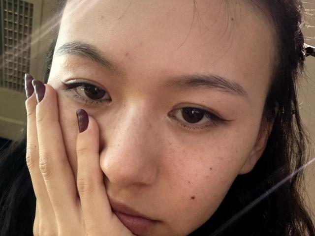 EmiliaBrackemyre has fair skin, dark eyebrows, and purple nail polish. Her hand with purple nails covers part of her face, showing freckles and a small mole.