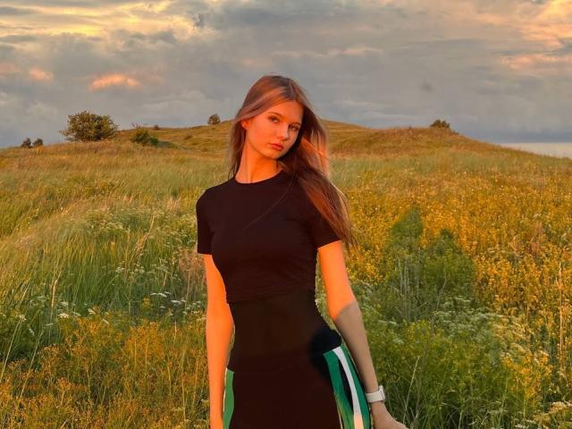 SuzieBrion with long brown hair, black top, and green/white striped bottom, standing in a sunlit grassy field, holding a white bracelet on her right wrist.