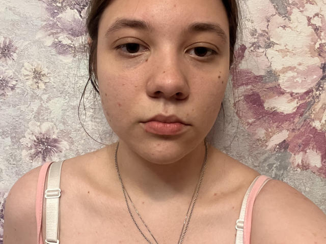 AureliaEmswiler has a neutral expression, light brown eyes, and a small nose with a few blemishes. She's wearing a pink strap top and a silver chain necklace.
