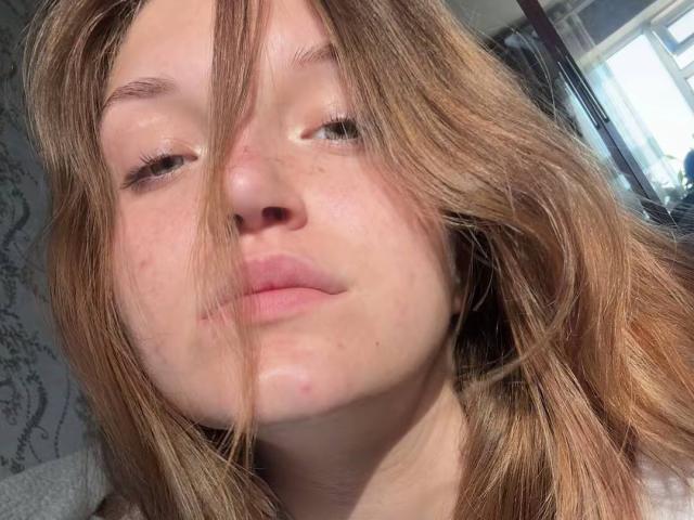 Il viso di KristinLory, con i capelli castano chiaro, leggermente disordinati, che le coprono gli occhi, ha un'espressione neutra, labbra rosate e qualche piccolo brufolo sulla guancia sinistra..