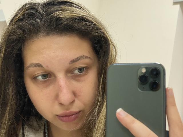 Sanella with light brown, wavy hair, holding a gray iPhone, looking into the camera, showing a slight pout, her green eyes are centered. Her face has a few small blemishes.