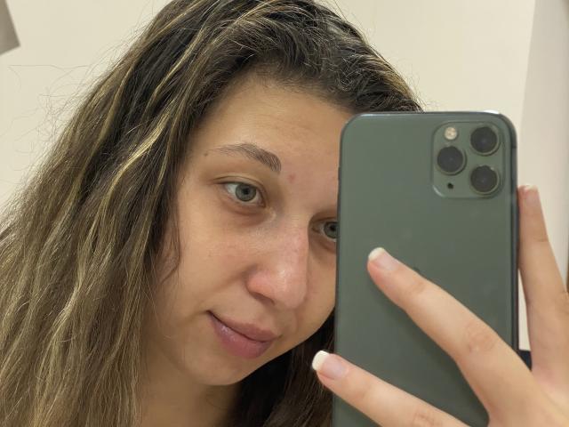 Sanella's face with wavy brown hair, green eyes, and slight smile, holding a green iPhone, showing a small zit on her right cheek. Her nails are neatly manicured.