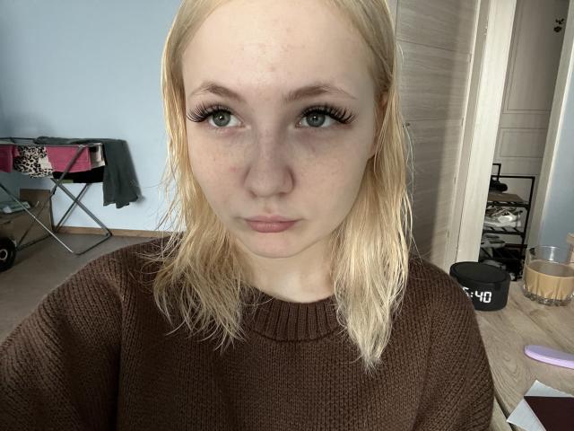 PorshaHondros, loira, com olhos verdes, vestindo um suéter marrom de tricô, tem um pequeno hematoma sob o olho direito e está olhando diretamente para a câmera com os lábios franzidos..
