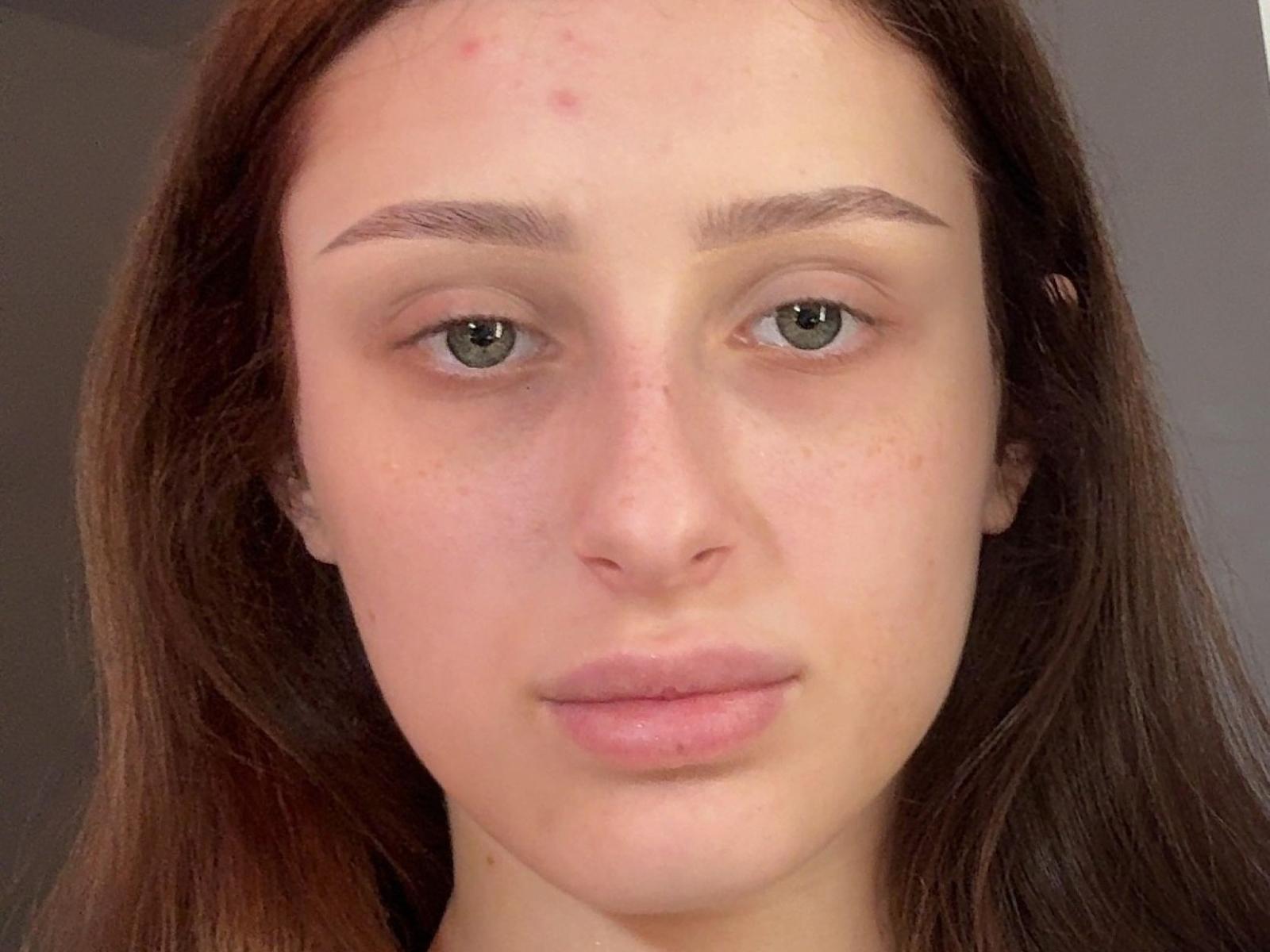 ElanorPappy tem pele clara, olhos verdes e cabelo castanho, com algumas manchas vermelhas na testa, e seus lábios rosados e cheios estão ligeiramente entreabertos..