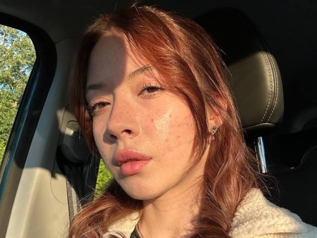 CamillaBoisson's face in a car, sunlight on her red hair, freckles, and pink lips, wearing a white fluffy jacket, with a black headrest behind her.