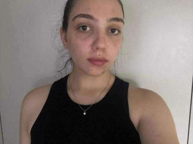 NeliaLisi with puffy, acne-scarred face, dark hair in messy ponytail, wearing black sleeveless top, small silver earrings, and delicate necklace, standing against white background.