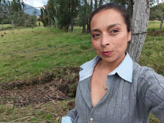 StangelarRivera with puffy lips, wearing a gray button-up shirt with a light blue collar, standing in front of a tree, green grass, and a wire fence in the background.
