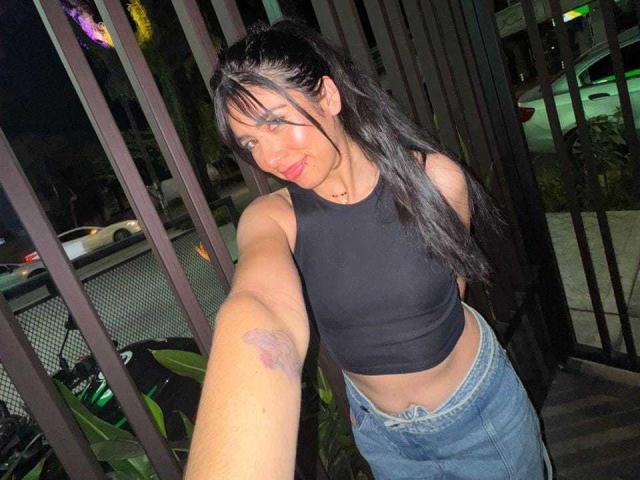MilusSky with long black hair, wearing a black crop top and blue jeans, showing a bruise on her arm, taking a selfie at night. Her tits are small.