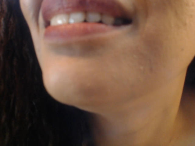 KenyaKarath's puffy, slightly parted lips showing white teeth with a subtle pinkish hue, and a small, visible zit on the right side of her chin.