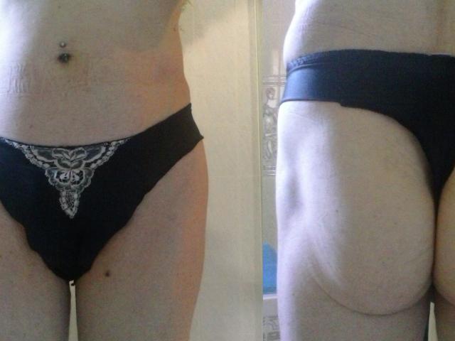 La biancheria intima nera di Hermeline, con dettagli in pizzo bianco, mostra il suo piercing all'ombelico e i glutei in due scatti speculari, uno frontale e uno posteriore. La sua pelle chiara e il leggero girovita sono visibili..