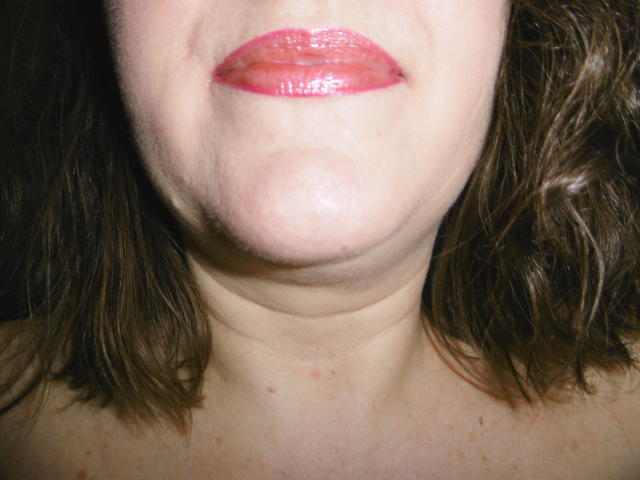 LiliChattePoilue's face, showing shiny pink lips, slightly flushed cheek, and brown wavy hair, with visible freckles on her neck and a subtle double chin.