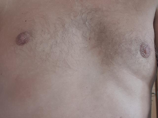 O peito de NaughtyHugues, com pele marrom-clara e peluda, pequenos mamilos eretos e pelos visíveis no peito. Os seios não são mostrados, apenas a parte superior do tronco..