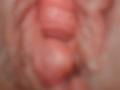 Blurry image of FrenchShanna's pink, swollen, circumcised cock with a shiny, reddish tip. The background is out of focus, making the cock the main visible element.