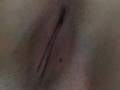 AlicaMihal's pussy, showing a slightly parted, brownish, textured, and slightly curved labia with a small black mole near the center.