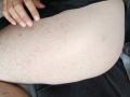 OrianaAndFriends' pale, hairy belly with small red bumps and a hand resting on the upper left. The hand has short, clean nails. OrianaAndFriends is wearing dark shorts.