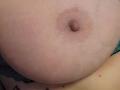 FrenchShanna's big, pale, round boobs with a small, brown nipple in the center, showing slight skin texture and a few small moles.