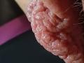 OrianaLaFrancaise's pink, wrinkled, textured boogers are in focus, showing detailed, bumpy, and slightly shiny skin. The boogers are to the right, with a tiny bit of hair.