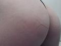 Les fesses de DiLaria, montrant une peau pâle avec de fines lignes rouges et un bandeau noir, capturées dans un gros plan. La texture est légèrement rugueuse, avec des lignes de peau visibles..